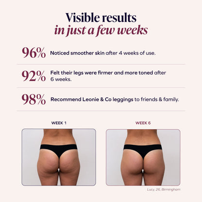 3D Anti-Cellulite Leggings